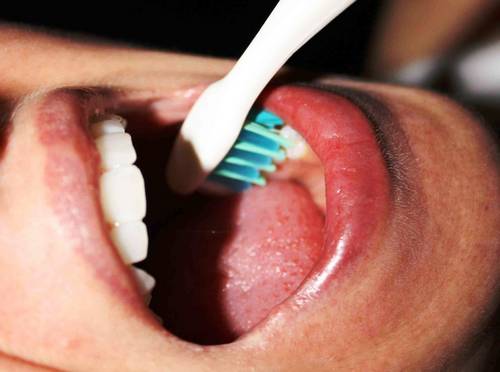رعایت نکات بهداشتی  دندان درخانه در قرن جدید چگونه باید باشد