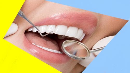 روشهای زیبایی دندان چیست ایا لمینت ها با هم متفاوت هستند
