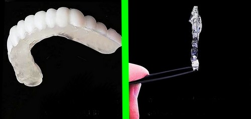 لمینت موقت دندان یک راه اسان برای دندان دار شدن 
